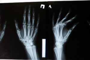 Referral for an X-ray – when is it needed and what does the procedure look like?