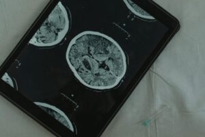 Невропатическая боль – причины, симптомы и современные методы лечения